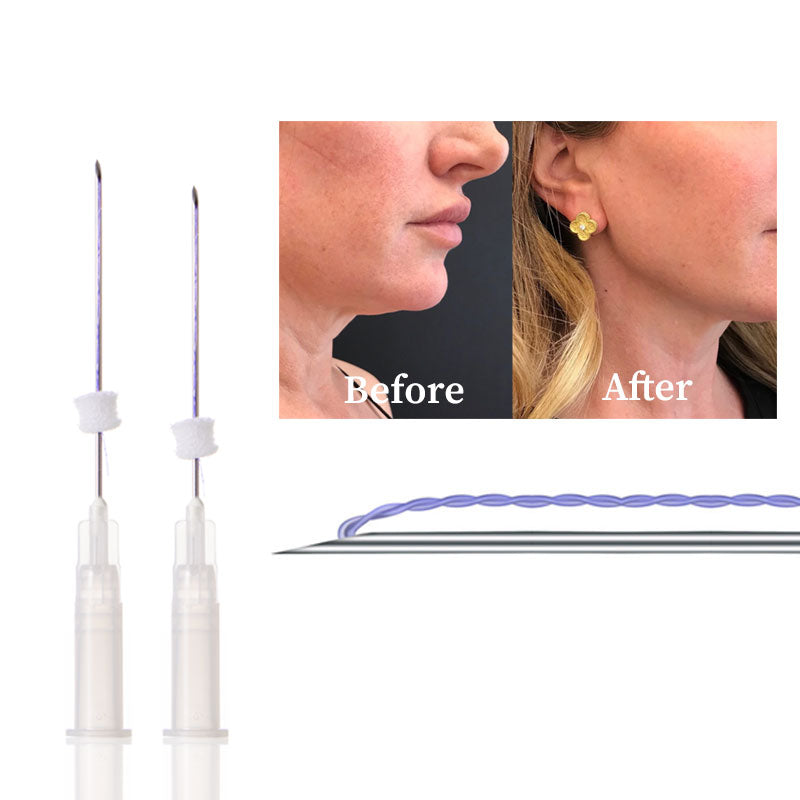 Deenora Tornado Thread Effectively targets skin depressions and lifts facial contours 40PCS