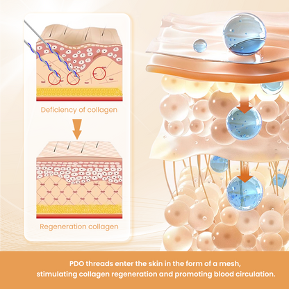 Auro PDO Mono Thread For Face and Body Lift