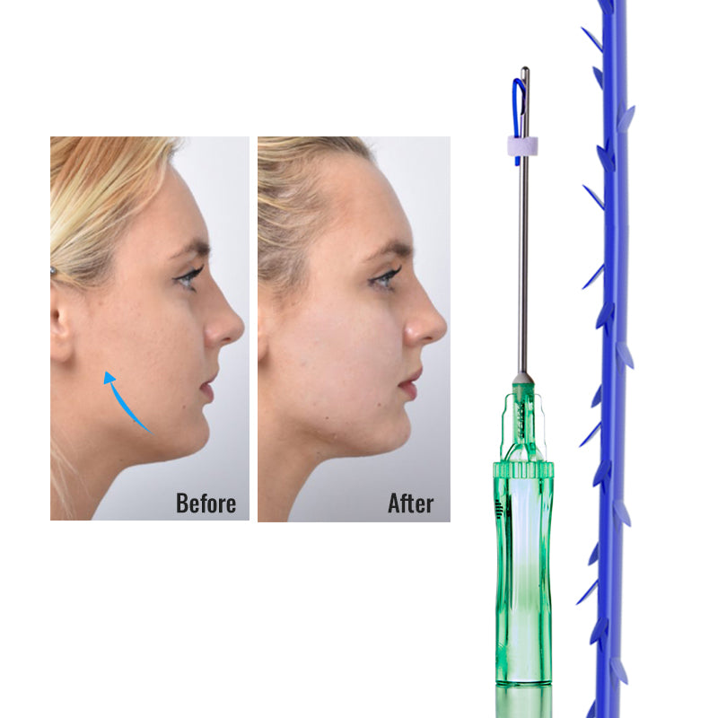 D.seahorse PDO Bidirectional Cog Thread is suitable for lifting the face and body.