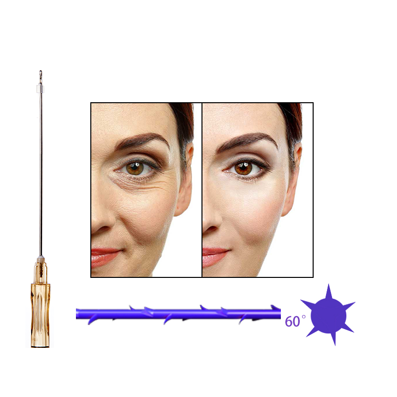 Deenora Pdo Cog 6D Thread For Face and Body  Blunt L W Type