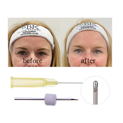 Deenora Pdo thread for Eye W blunt 30G 25MM 38MM