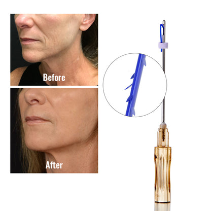 Auro PDO Cog 4D Thread Face Jawline Foxeye Lift