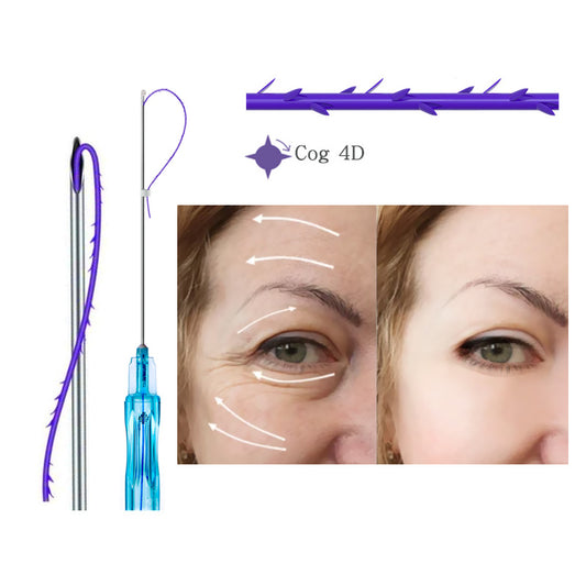 Deenora Pdo Cog Thread  Face and Body Lift Aseptic packaging