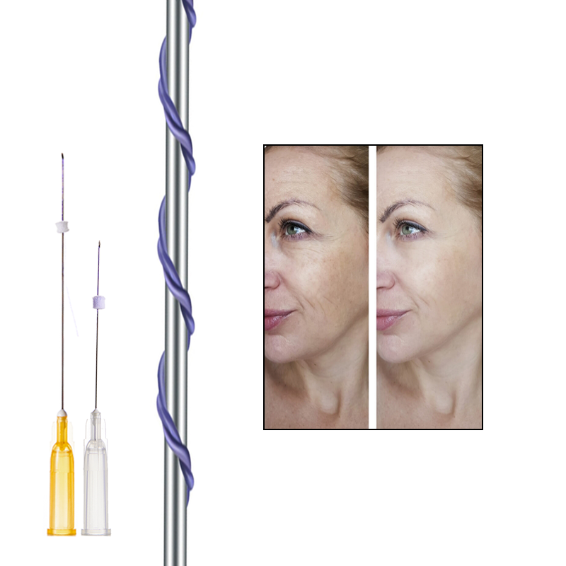 Deenora Pdo Thread Tornado Screw  Type Sharp Needle