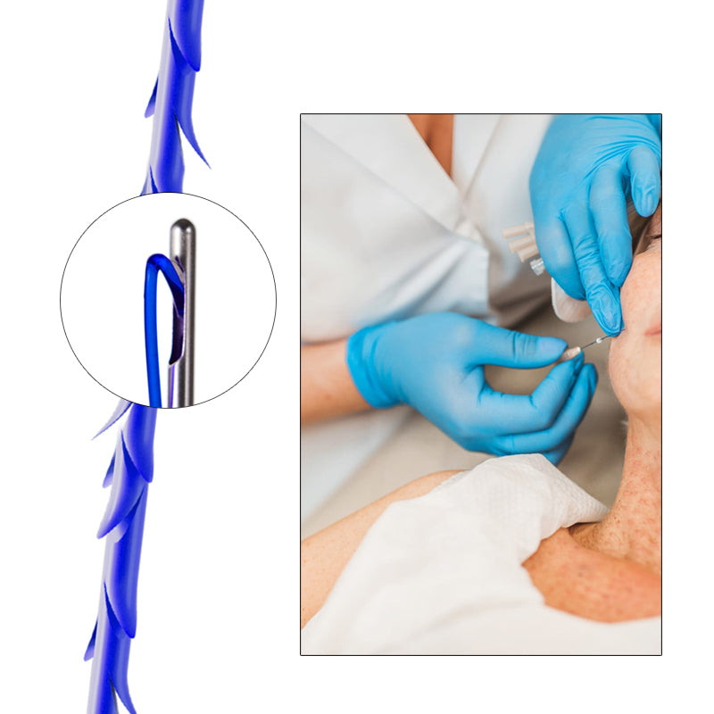 Firmosa Pdo Cog  Thread 6D Long Lasting Lift for Face and Body