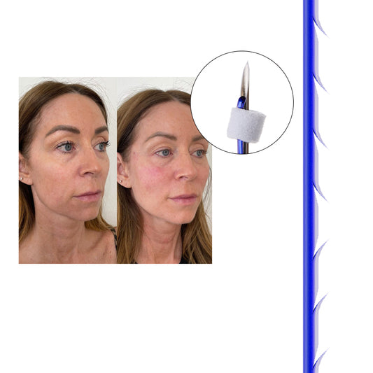 Auro PDO Barbed Cog 5-1 Thread Sharp Needle