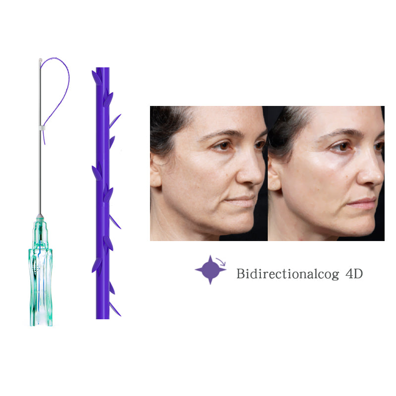 D.seahorse PDO Bidirectional Cog Thread is suitable for lifting the face and body.