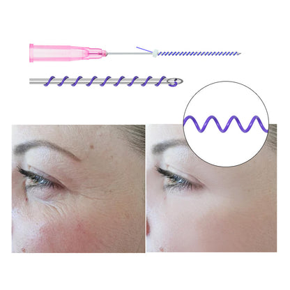 Deenora  PDO Mono Screw Thread Lifting For Face Sharp Needle