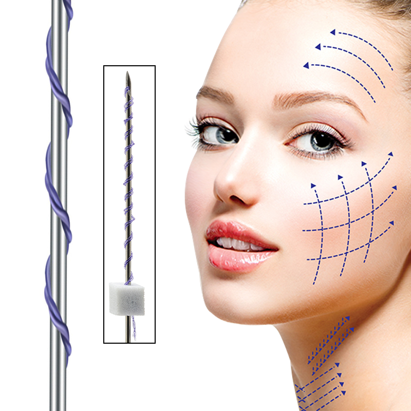 Deenora Pdo Thread Tornado Screw  Type Sharp Needle